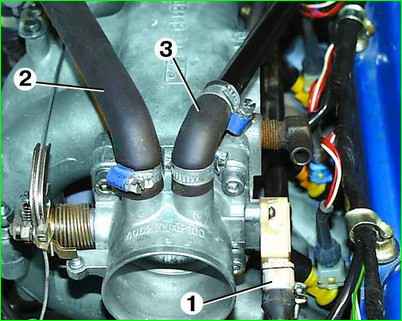 Entfernen der Drosselklappenbaugruppe