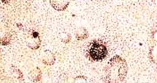 Виды и причины дефектов лакокра­сочных покрытий