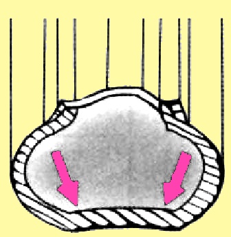 Виды износа протекторов шин автомобилей