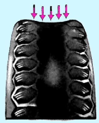 Виды износа протекторов шин автомобилей