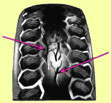 Виды износа протекторов шин автомобилей